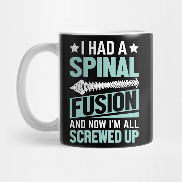 I Had A Spinal Fusion And Now I'm All Screwed Up Funny Spine by Boneworkshop